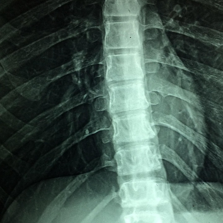 spinal health clinic